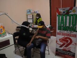 Polres Situbondo Beri Layanan Hapus Tato Gratis di Hari Bhayangkara ke -79